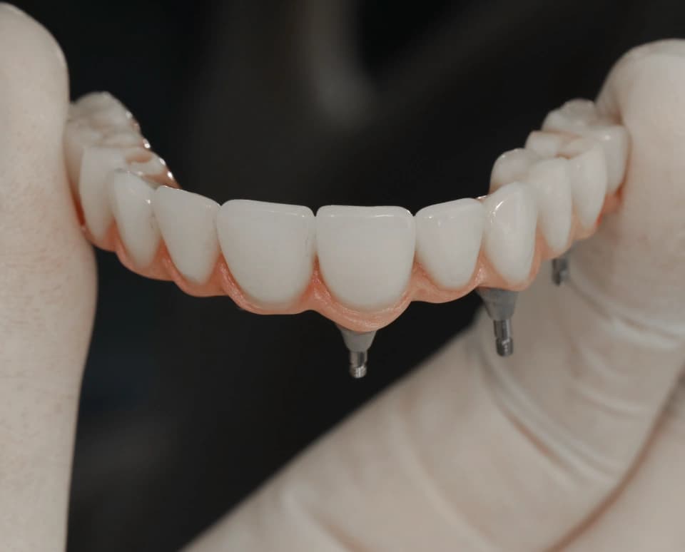 Solução para sorriso saudável