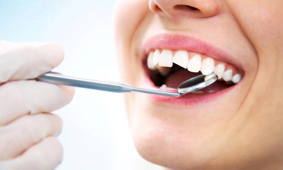 Lasquei um dente, e agora o que faço? Lasquei um dente, e agora o que faço?