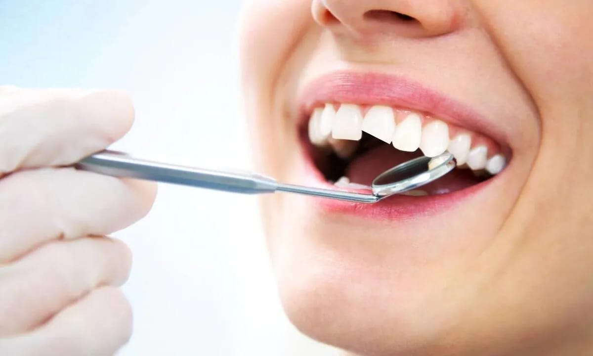 Lasquei um dente, e agora o que faço? Lasquei um dente, e agora o que faço?