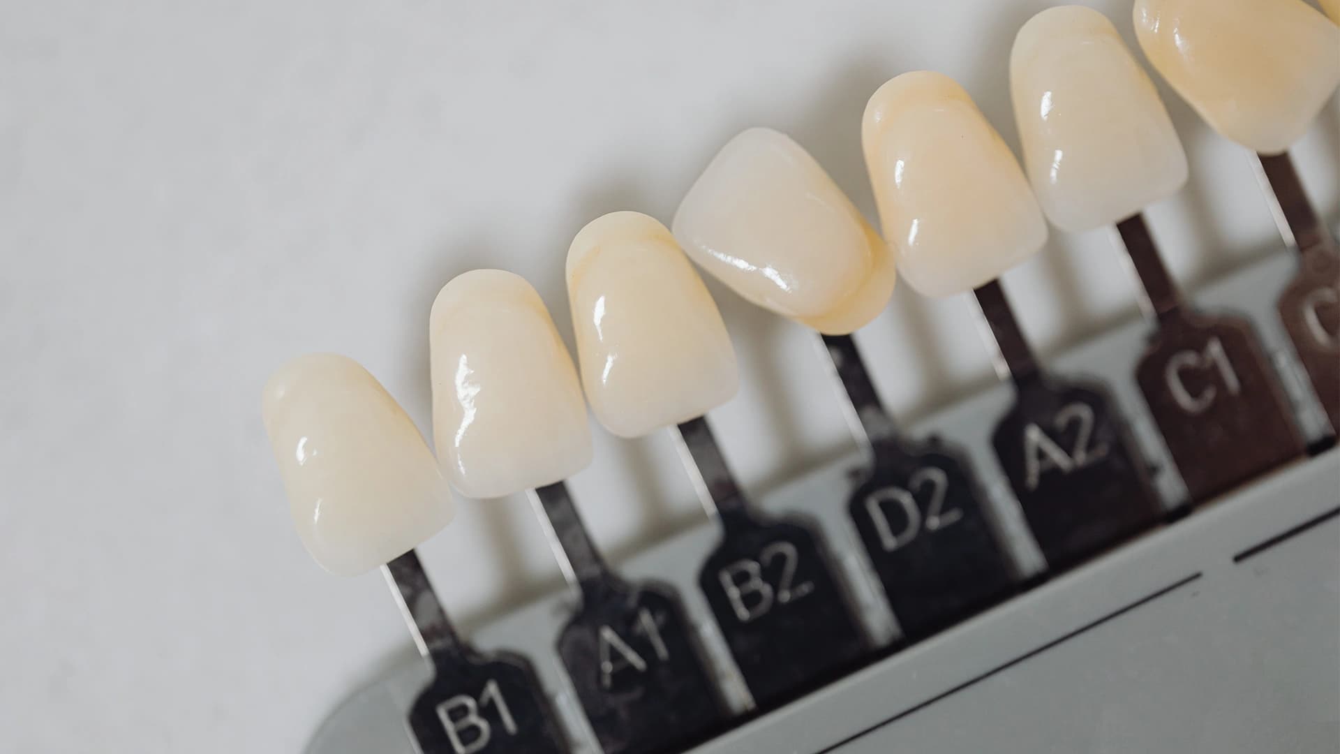 Reabilitação estética: o que precisa de saber Reabilitação estética: o que precisa de saber