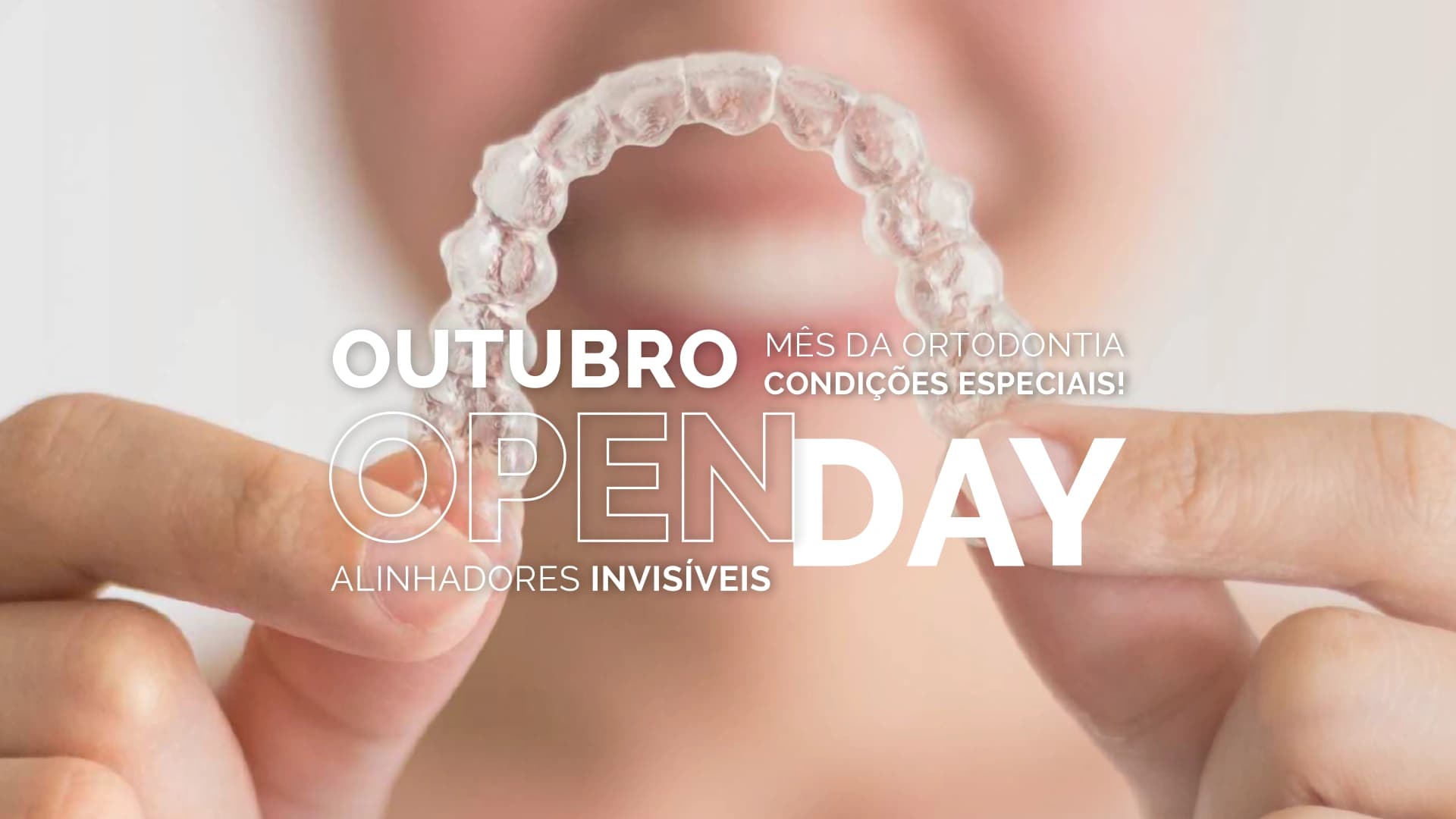 Mês da Ortodontia: Alinhadores Invisíveis Mês da Ortodontia: Alinhadores Invisíveis