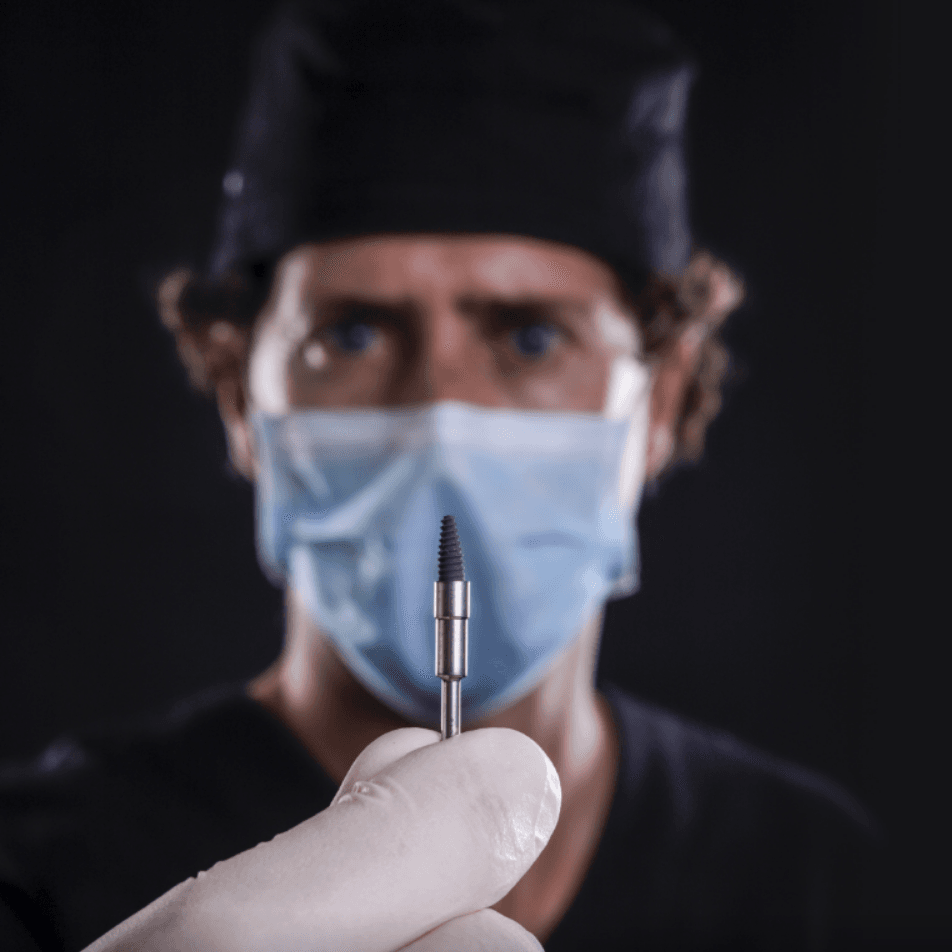 Implantes dentários Implantes dentários
