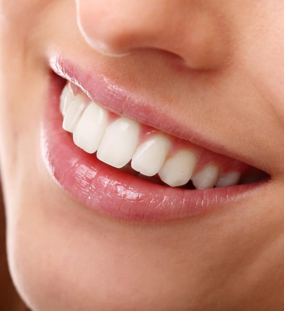 Tratamento eficaz e duradouro | Carreira Dental Clinic Tratamento eficaz e duradouro